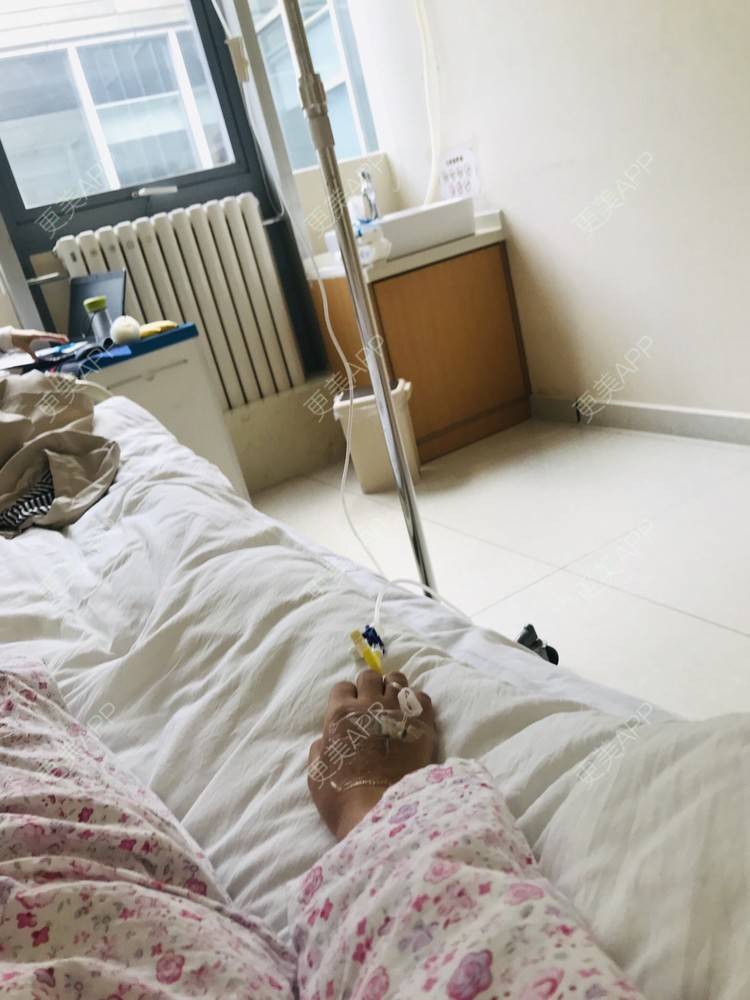 更美 - 🐻可爱嘚、布鲁鲁的吸脂去副乳经验 | 自体脂肪隆胸 | 吸脂去副乳 | 北京