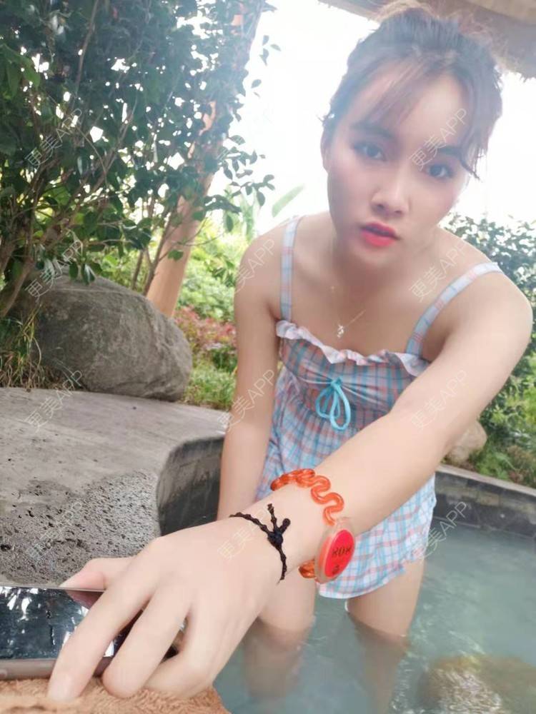 更美 - 青苔上的蜗牛的吸脂瘦脸经验 | 吸脂瘦脸 | 重庆