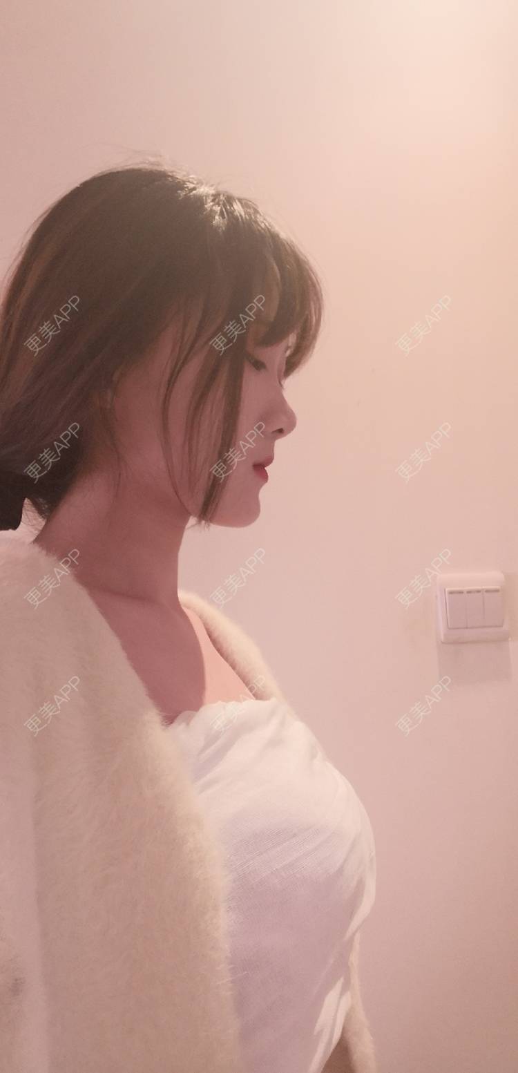 更美 - 更美用户tEAX7f1cKN的假体隆胸经验 | 假体隆胸 | 广州