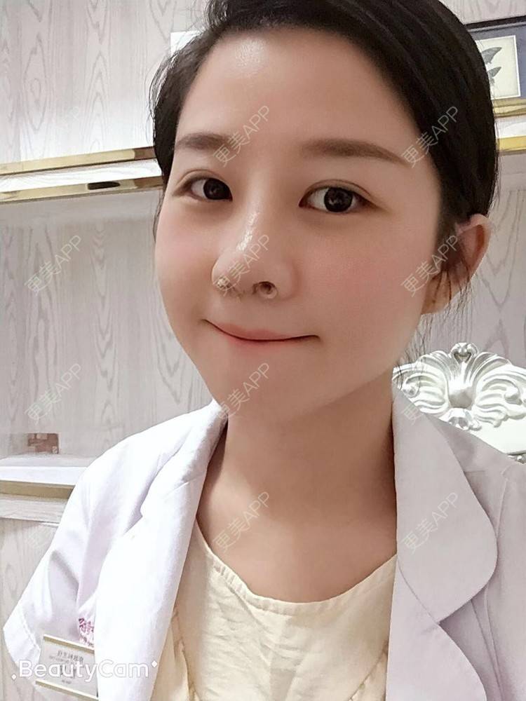 更美 - 更美用户1UKNNJxuNe的鼻部多项经验 | 耳软骨隆鼻 | 赣州 | 鼻部多项