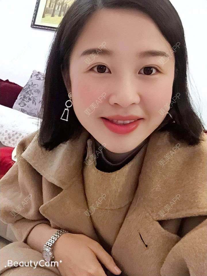 更美 - 更美用户1UKNNJxuNe的鼻部多项经验 | 耳软骨隆鼻 | 赣州 | 鼻部多项