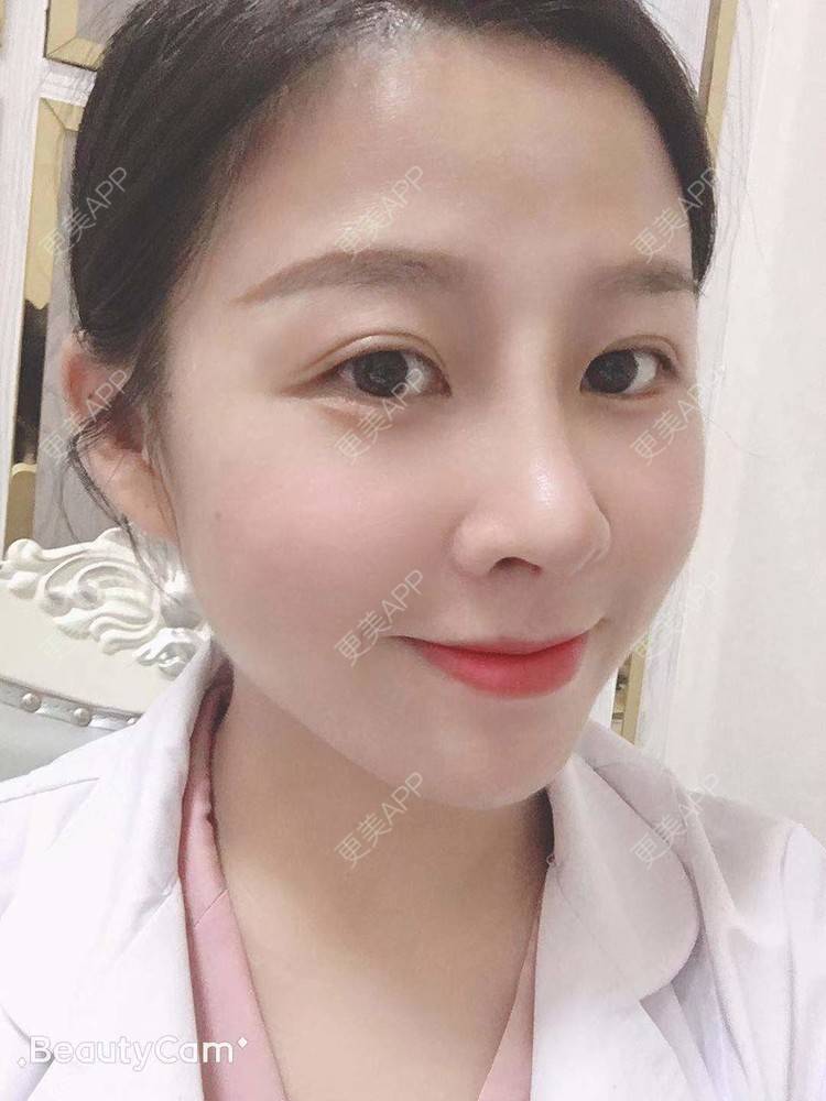 更美 - 更美用户1UKNNJxuNe的鼻部多项经验 | 耳软骨隆鼻 | 视频日记 | 赣州 | 鼻部多项