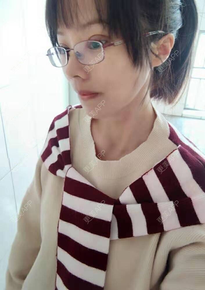 更美 - 我叫小芳的凸嘴矫正经验 | 凸嘴矫正 | 广州