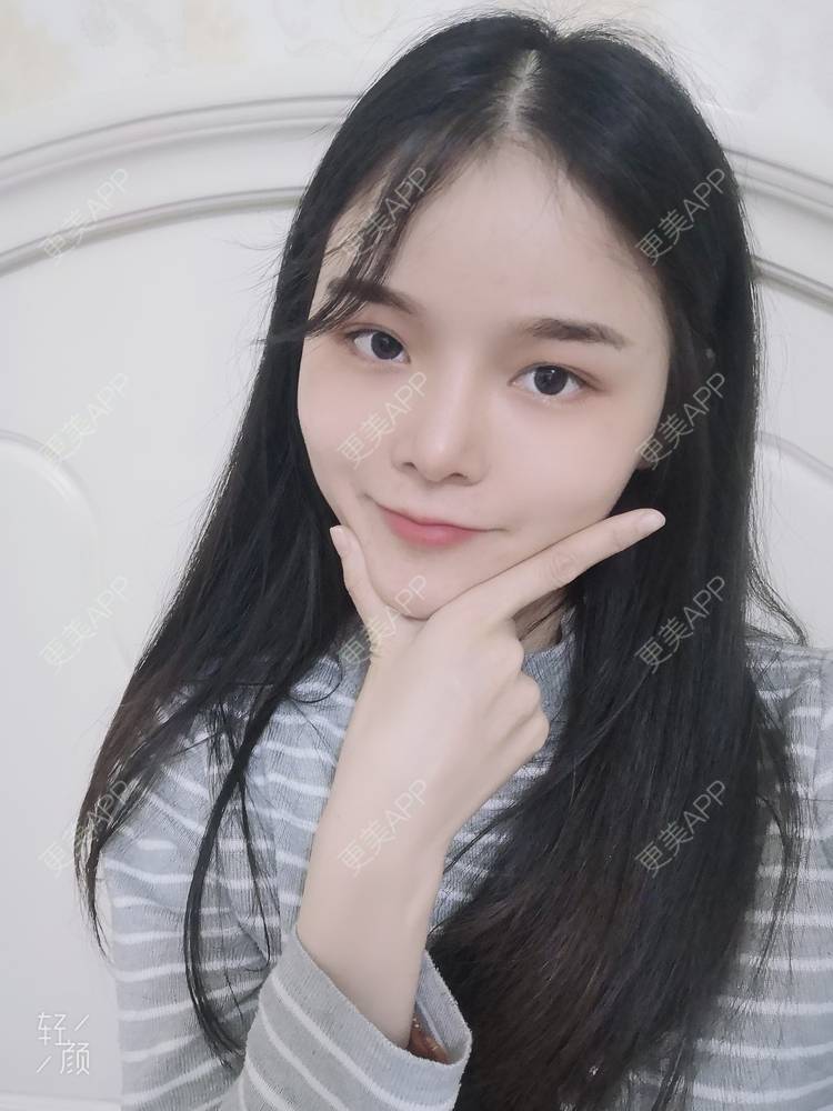 更美 - 莫宁🌸的自体脂肪填充泪沟经验 | 自体脂肪丰太阳穴 | 自体脂肪丰额头 | 自体脂肪丰苹果肌 | 自体脂肪丰面颊 | 自体脂肪填充泪沟 | 自体脂肪垫下巴 | 广州 | 视频日记