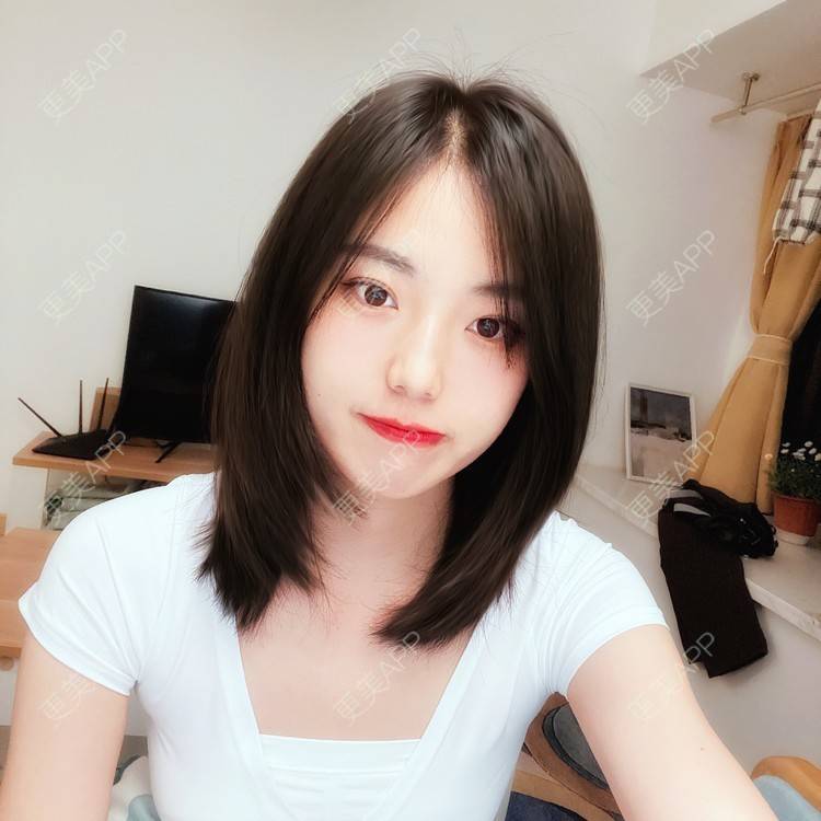 更美 - 菲儿好菇凉的双眼皮经验 | 双眼皮 | 全切双眼皮 | 埋线双眼皮 | 定点双眼皮 | 眼皮下垂矫正 | 重庆 | 上眼睑去脂 | 眼部多项