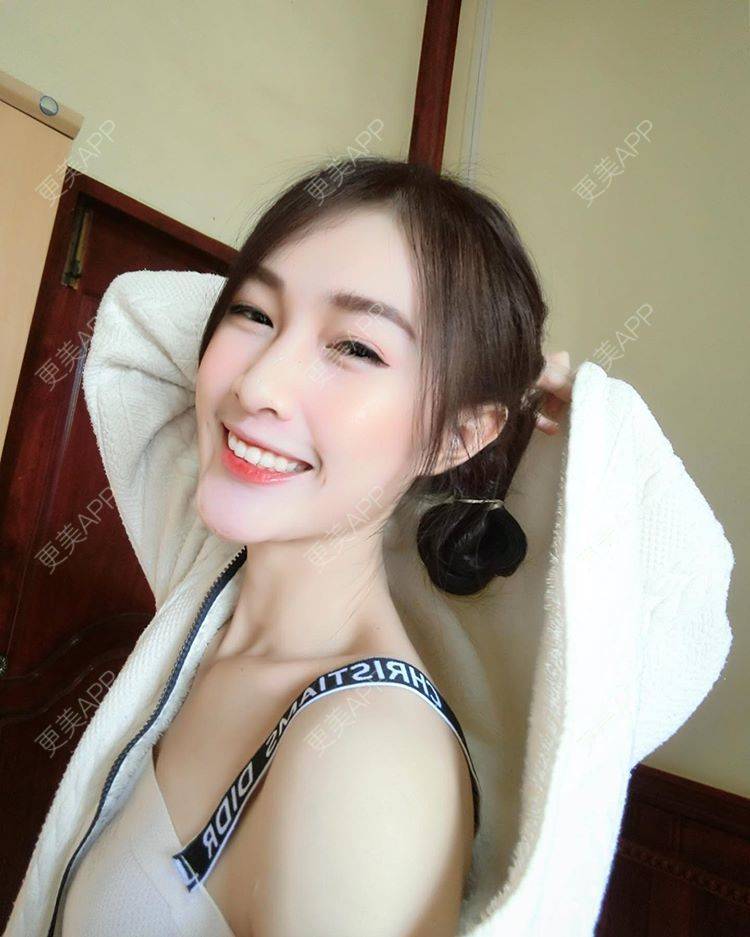 更美 - 云如枫的玻尿酸导入经验 | 玻尿酸导入 | 深圳