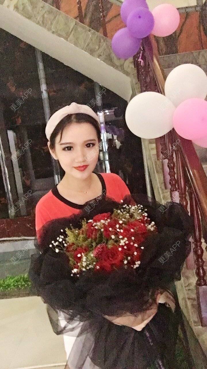 更美 - 更美用户T8WaNbmjvG的热玛吉经验 | 深圳 | 热玛吉 | 超声提升 | 埋线提升 | 热拉提