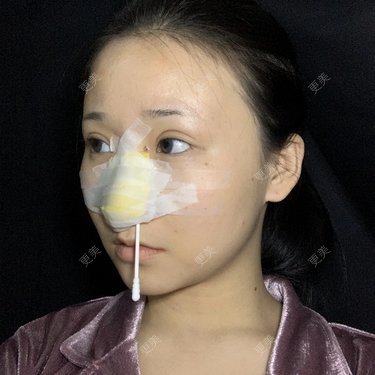 更美用户A9XbUpVyAA