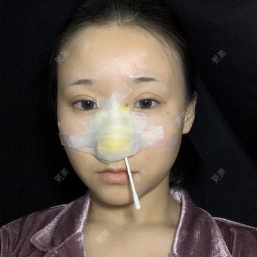更美用户A9XbUpVyAA