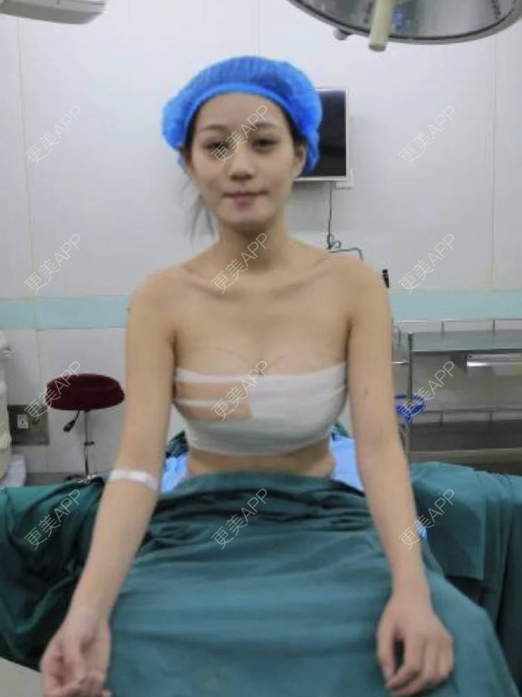 更美 - 更美用户2ldFVUKSO7的假体隆胸经验 | 假体隆胸 | 南昌