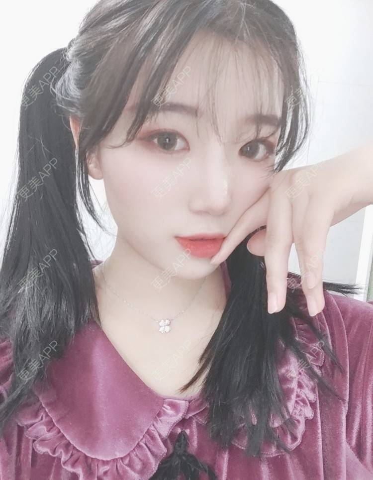 更美 - 更美用户QNJUWn1nDs的吸脂去副乳经验 | 吸脂去副乳