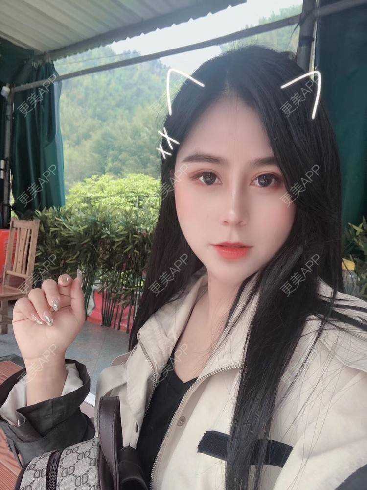 更美 - 更美用户zwQN5e8jIh的鼻部多项经验 | 鼻部多项 | 长沙