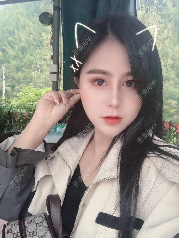 更美 - 更美用户zwQN5e8jIh的鼻部多项经验 | 鼻部多项 | 长沙