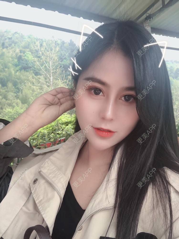 更美 - 更美用户zwQN5e8jIh的鼻部多项经验 | 鼻部多项 | 长沙