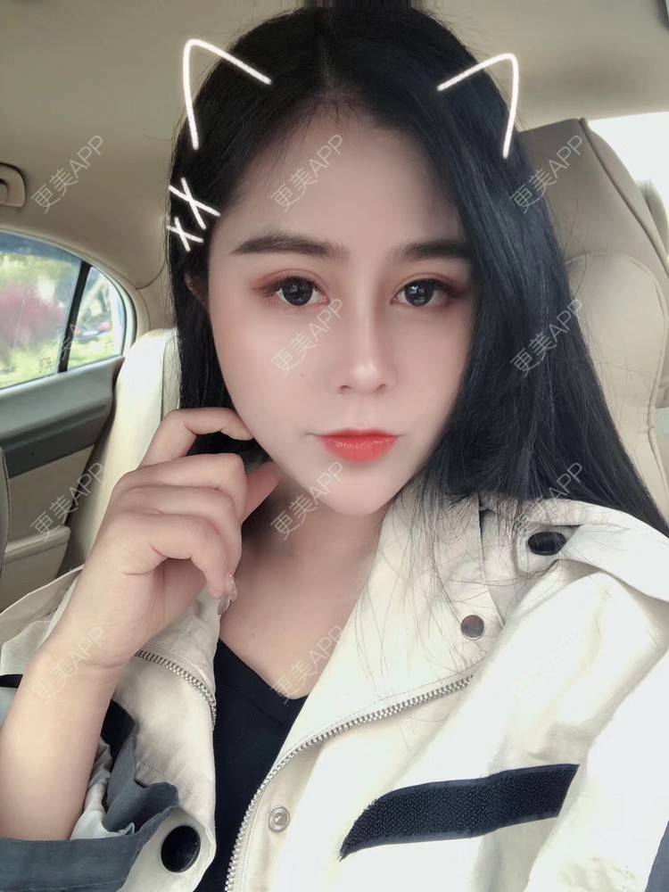 更美 - 更美用户zwQN5e8jIh的鼻部多项经验 | 鼻部多项 | 长沙