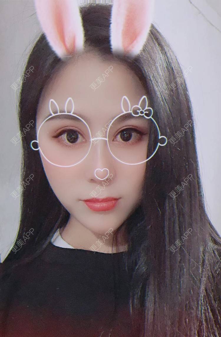 更美 - 更美用户zwQN5e8jIh的鼻部多项经验 | 鼻部多项 | 长沙