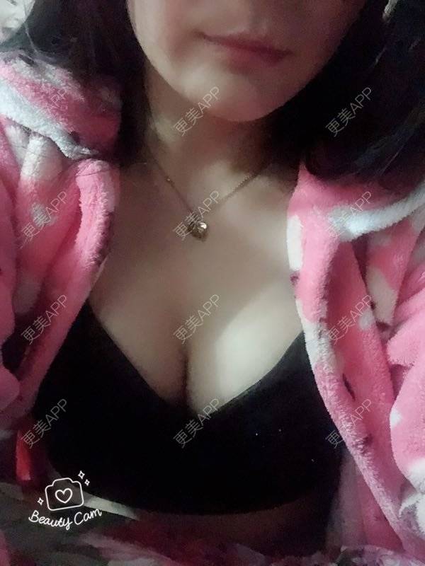 更美 - 想走就走啊的自体脂肪隆胸经验 | 上海 | 自体脂肪隆胸