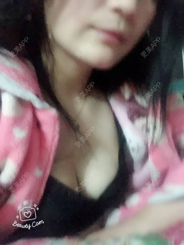 更美 - 想走就走啊的自体脂肪隆胸经验 | 上海 | 自体脂肪隆胸