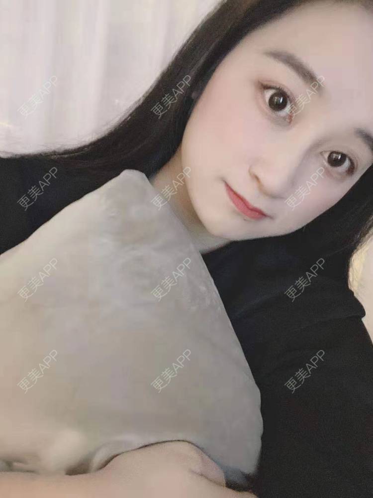 更美 - 更美用户129LF9Yh6a的玻尿酸下巴经验 | 视频日记 | 玻尿酸下巴 | 广州