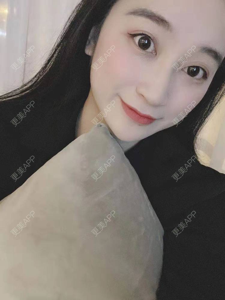 更美 - 更美用户129LF9Yh6a的玻尿酸下巴经验 | 视频日记 | 玻尿酸下巴 | 广州