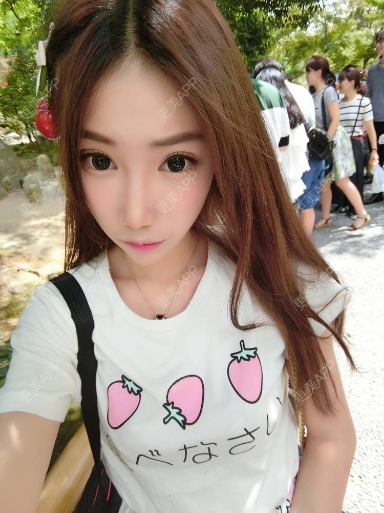 更美 - 更美用户CtyKQOVhTP的双眼皮修复经验 | 上海 | 双眼皮修复