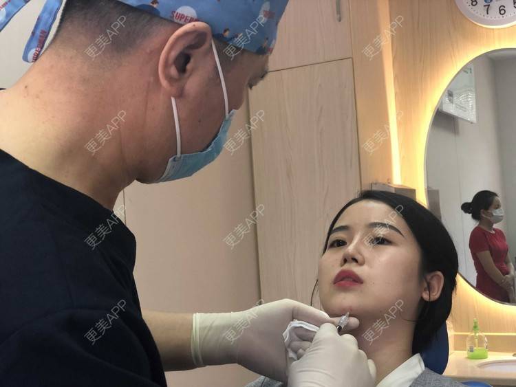 更美 - 更美用户cA33i6DxJX的玻尿酸下巴经验 | 玻尿酸下巴 | 上饶