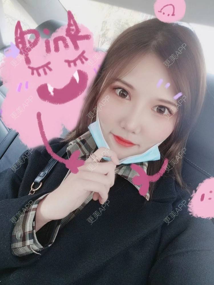 更美 - Lina丽娜的水氧活肤经验 | 更美研究所 | 小气泡 | 皮肤综合管理套餐 | 水氧活肤 | 上海