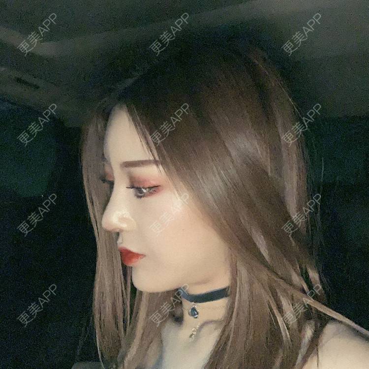 更美 - 更美用户1HlUvPqBUh的鼻部多项经验 | 青岛 | 鼻部多项