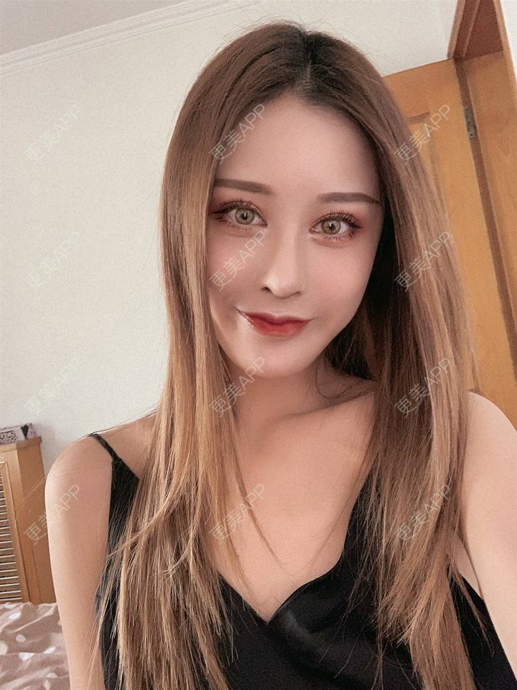 更美 - 更美用户1HlUvPqBUh的鼻部多项经验 | 青岛 | 鼻部多项
