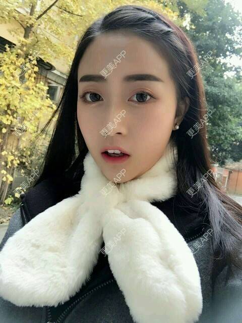 更美 - 心中始终有你的玻尿酸下巴经验 | 玻尿酸下巴 | 硅胶垫下巴 | 膨体垫下巴 | 缩下巴 | 成都