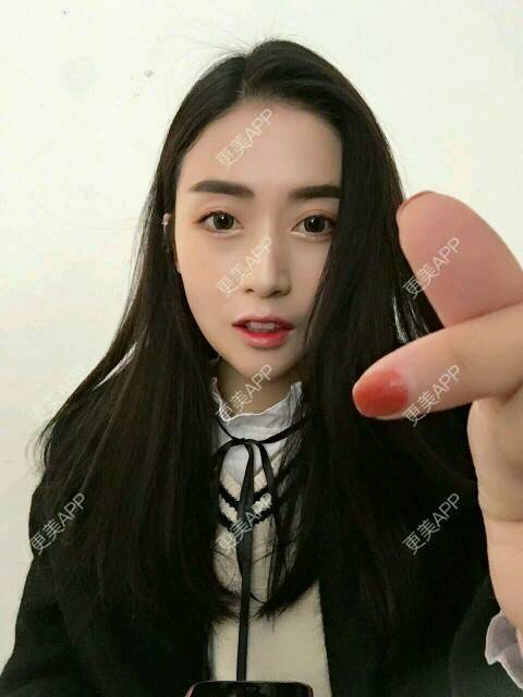 更美 - 心中始终有你的玻尿酸下巴经验 | 玻尿酸下巴 | 硅胶垫下巴 | 膨体垫下巴 | 缩下巴 | 成都