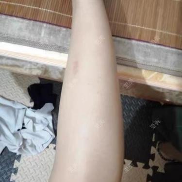 更美用户8KNprtzHH7