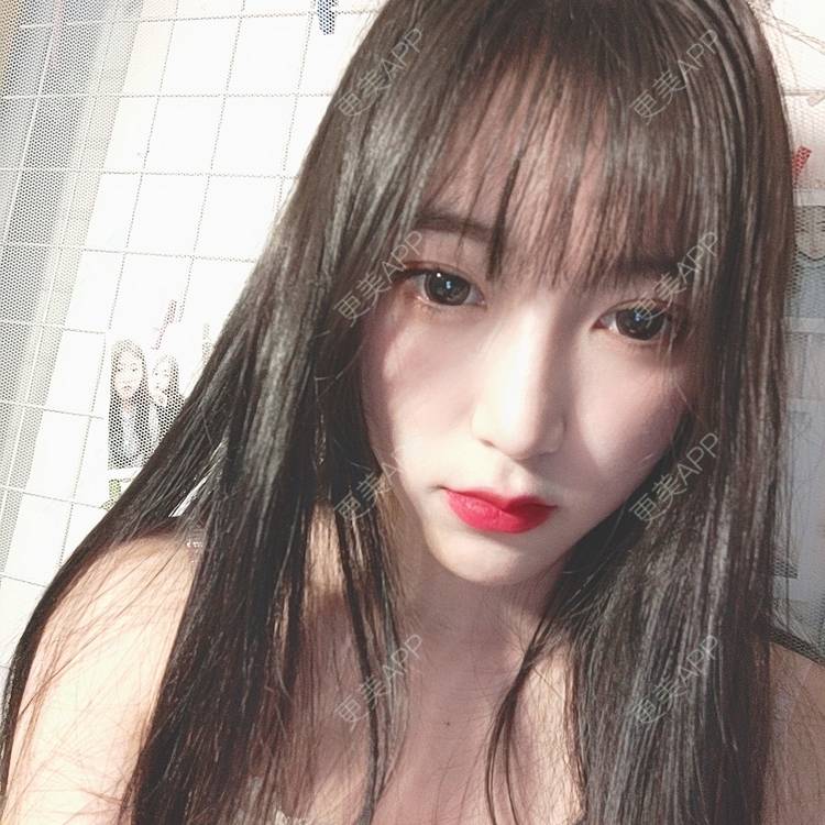 更美 - 更美用户F38SI0FUnA的埋线提升经验 | 埋线提升 | 东莞