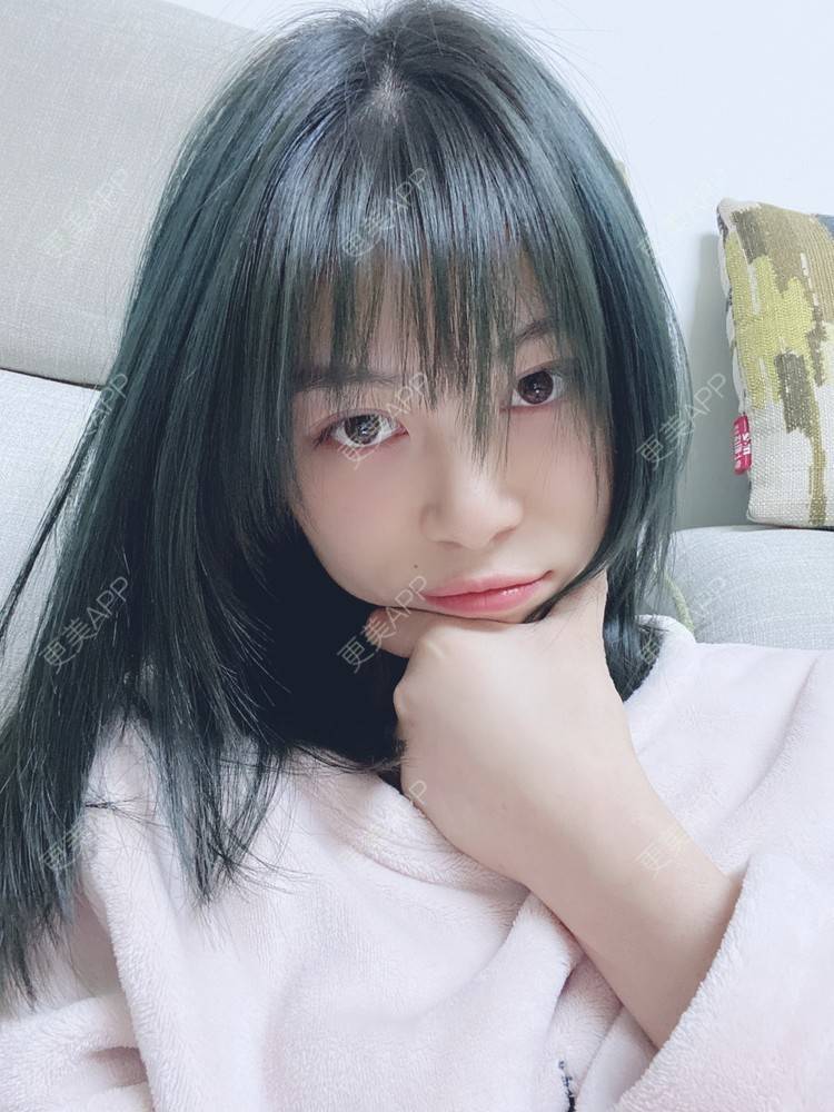 更美 - 更美用户nh0OukLNMd的牙齿矫正经验 | 牙齿矫正 | 成都
