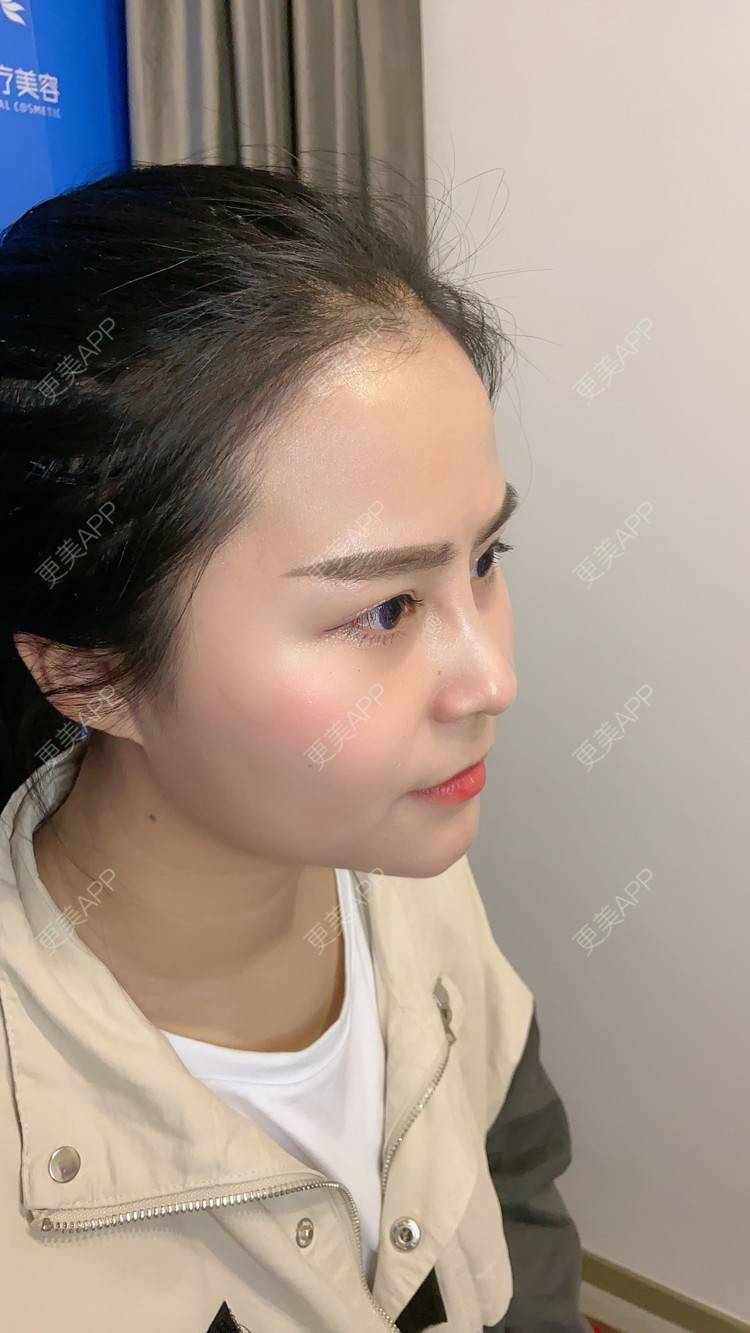 更美 - 更美用户zwQN5e8jIh的鼻部多项经验 | 鼻部多项 | 长沙