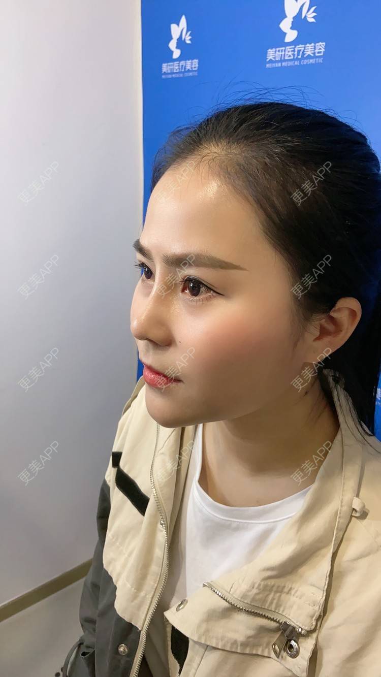 更美 - 更美用户zwQN5e8jIh的鼻部多项经验 | 鼻部多项 | 长沙