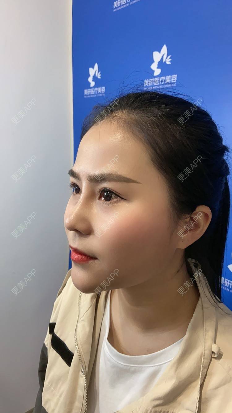 更美 - 更美用户zwQN5e8jIh的鼻部多项经验 | 鼻部多项 | 长沙