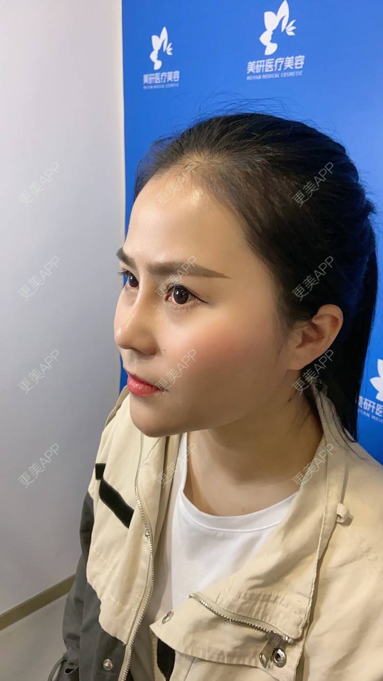 更美 - 更美用户zwQN5e8jIh的鼻部多项经验 | 鼻部多项 | 长沙