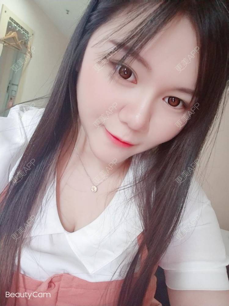 更美 - sonder.的下巴经验 | 下巴 | 硅胶垫下巴 | 长沙 | 视频日记