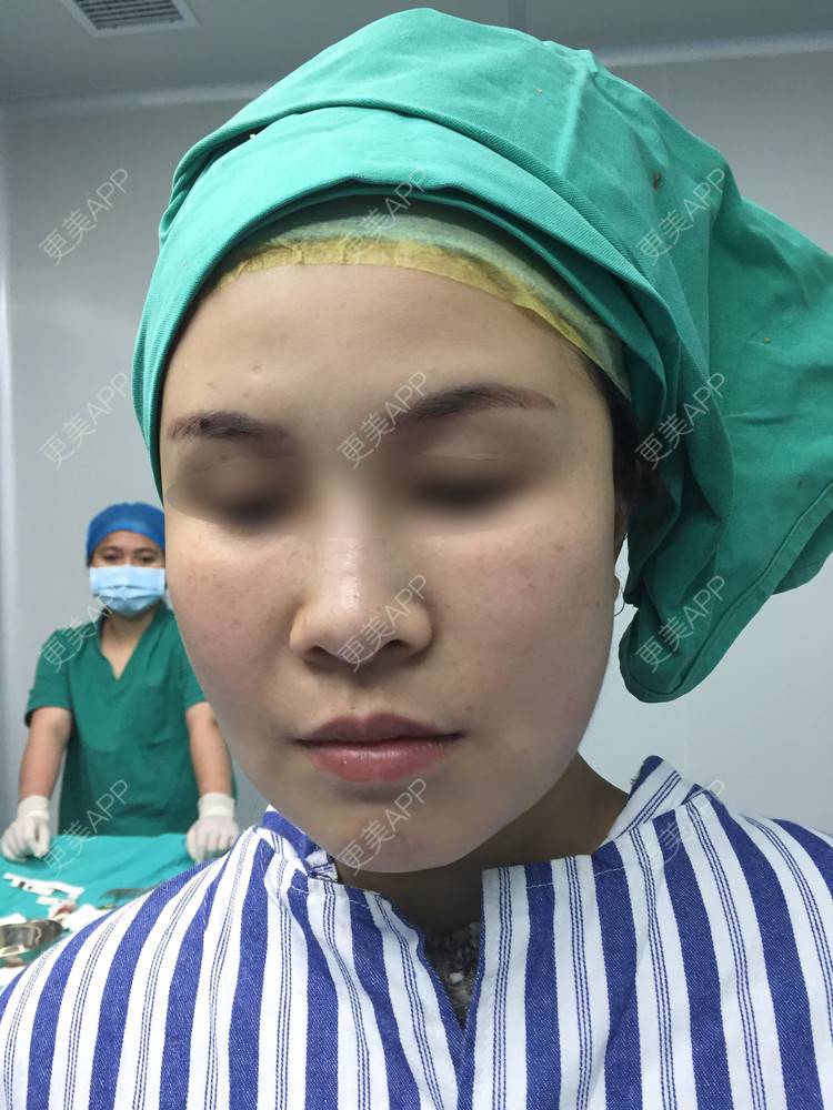 更美 - 蓝涵涵的拉皮经验 | 拉皮 | 广州