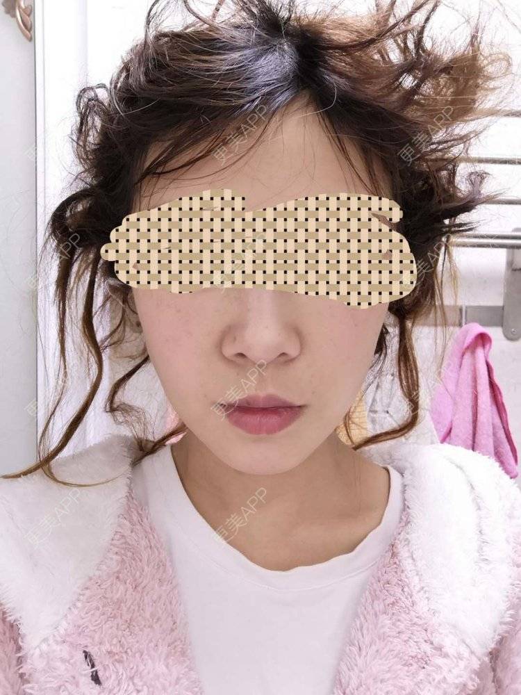 更美 - 蓝涵涵的拉皮经验 | 拉皮 | 广州