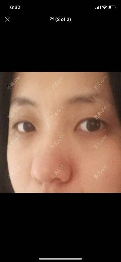 更美 - 发光费电i汾的胶原蛋白淡化黑眼圈经验 | 胶原蛋白淡化黑眼圈 | 北京