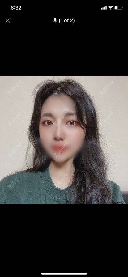 更美 - 发光费电i汾的胶原蛋白淡化黑眼圈经验 | 胶原蛋白淡化黑眼圈 | 北京