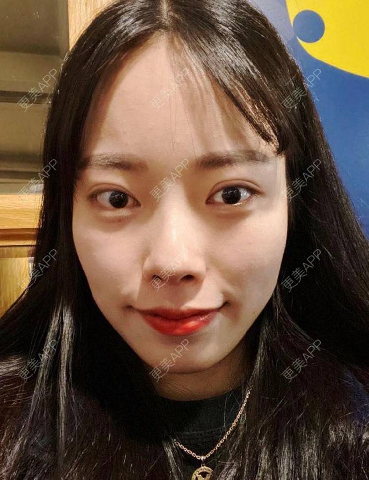 更美 - 可可姐姐很怪的胶原蛋白淡化黑眼圈经验 | 胶原蛋白淡化黑眼圈 | 胶原蛋白丰泪沟 | 杭州