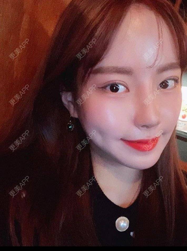 更美 - 可可姐姐很怪的胶原蛋白淡化黑眼圈经验 | 胶原蛋白淡化黑眼圈 | 胶原蛋白丰泪沟 | 杭州