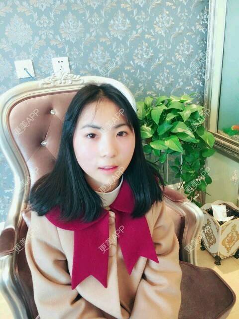更美 - 更美用户tjHPvupXhN的玻尿酸下巴经验 | 硅胶垫下巴 | 膨体垫下巴 | 缩下巴 | 玻尿酸下巴 | 成都