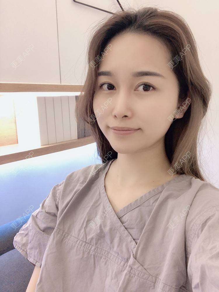 更美 - 甜心泡芙的双眼皮修复经验 | 双眼皮 | 开内眼角 | 双眼皮修复 | 全切双眼皮 | 重庆