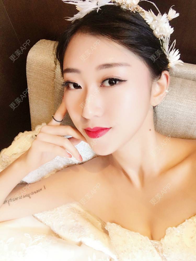 更美 - 李桥莲 医生的鼻翼缩小经验 | 视频日记 | 鼻翼缩小 | 泉州