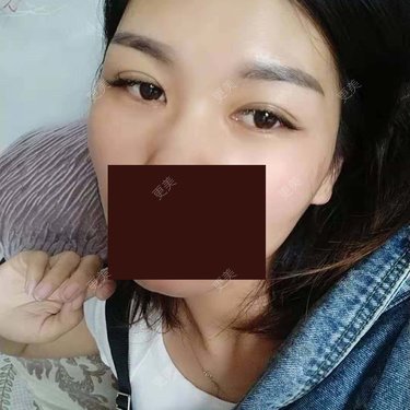 杨丽 医生