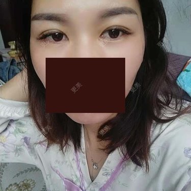 杨丽 医生